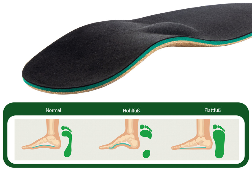 Einlegesohlen sind mit verschiedenen Gewölbestützhöhen erhältlich