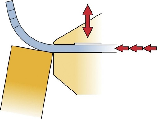 Schematische Darstellung des neuen RAS-Crown-Tools