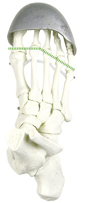 



Die natürliche Abknick-linie bezieht alle fünf Zehen in die Abrollbewegung ein
